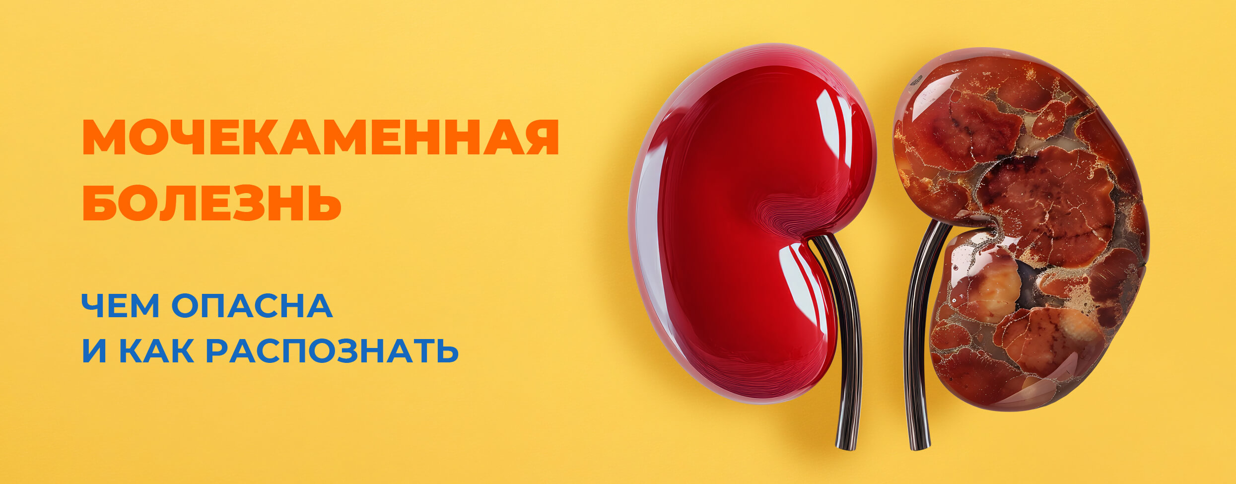 Мочекаменная болезнь.Чем опасна и как распознать