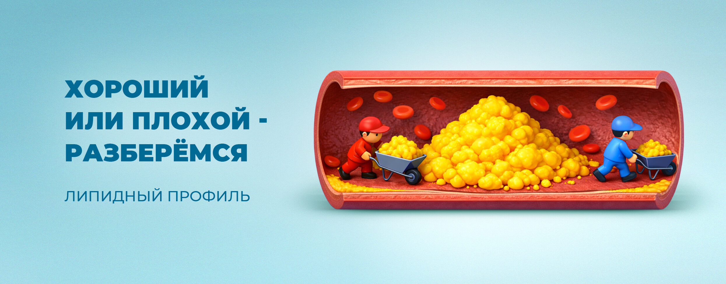 Хороший или плохой - разберёмся. Липидный профиль